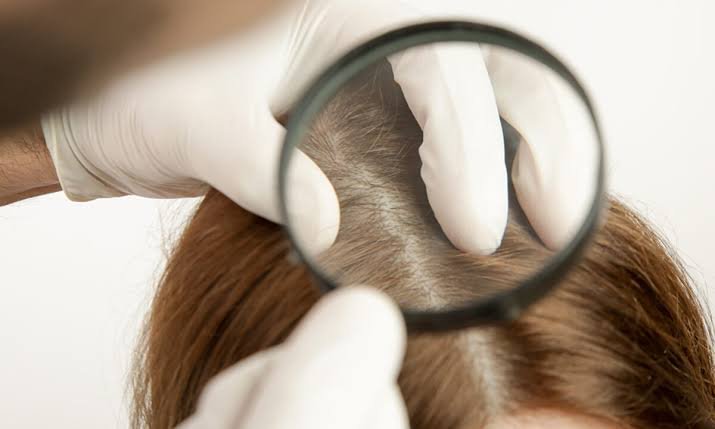Hair loss evaluation - Dr Shubham Singh