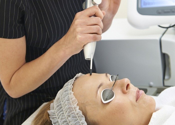 Q Switch Laser - Dr Shubham Singh