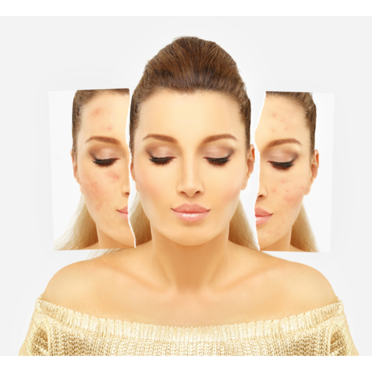 before after - Dr Shubham Singh