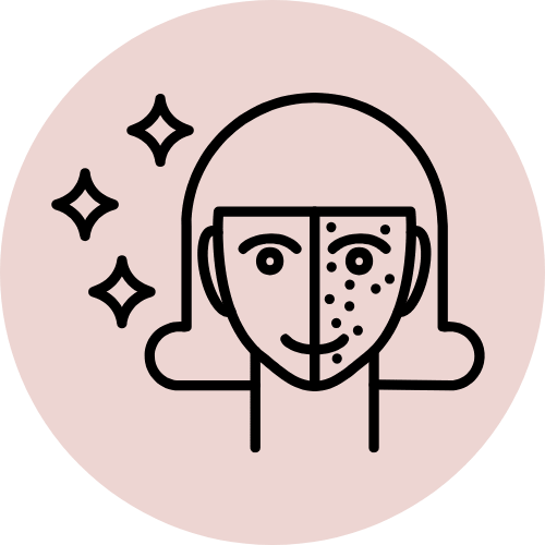 icon pigmentation - Dr Shubham Singh