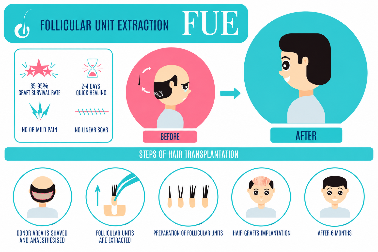 FUE Hair Transplantation Infographic - Dr Shubham Singh