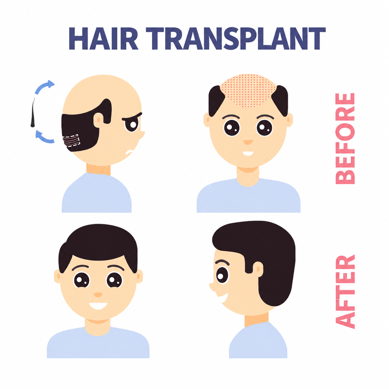 Hair Transplant Before and After Infographic - Dr Shubham Singh